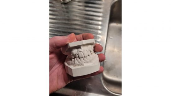 Warhammer 40k a dental cast, that's about to be used for a model