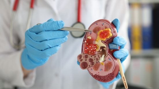 Warhammer 40k Space Marine organs - scientist holds a kidney